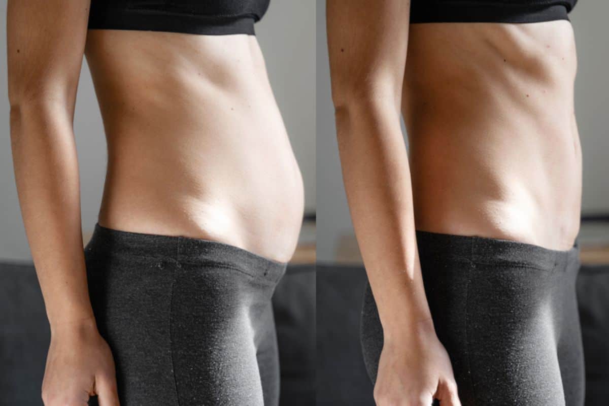 Post-Pregnancy: What Happens to Your Abdominal Muscles After Birth Wanstead