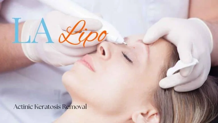 Woman receiving Actinic Keratosis Removal Treatment Wanstead