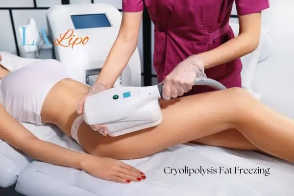 Woman receiving coolsculpting Wanstead treatment on her thighs