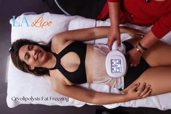 woman getting cryolipolysis Wanstead
