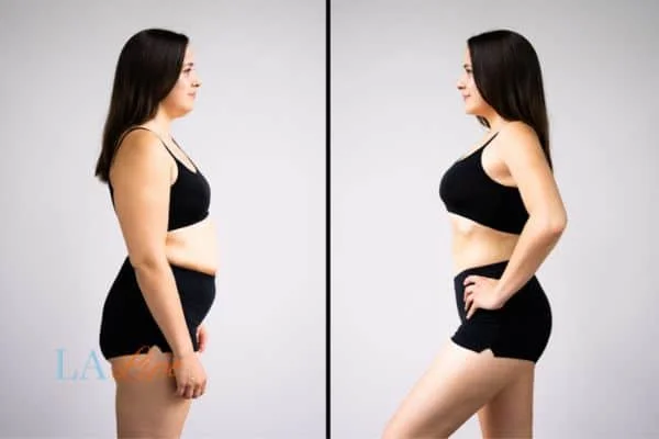 link between body image and mental health Wanstead