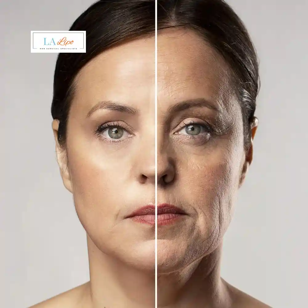 How Can You Tell If Non-Surgical Skin Tightening Is Right for You Wanstead?
