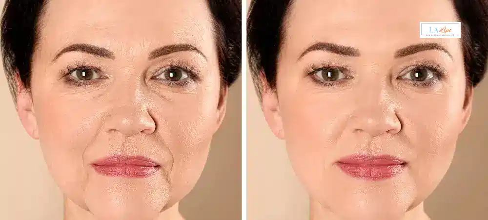 How Long Does It Take to See Results and How Long Do They Last Wanstead?