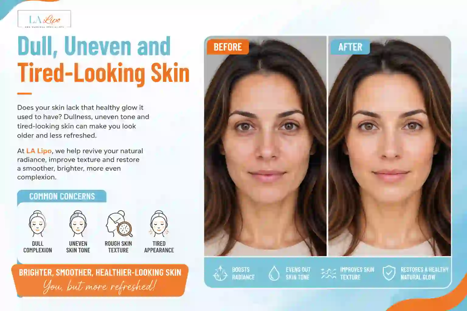 Sign #5: Dull, Uneven and Tired-Looking Skin Wanstead