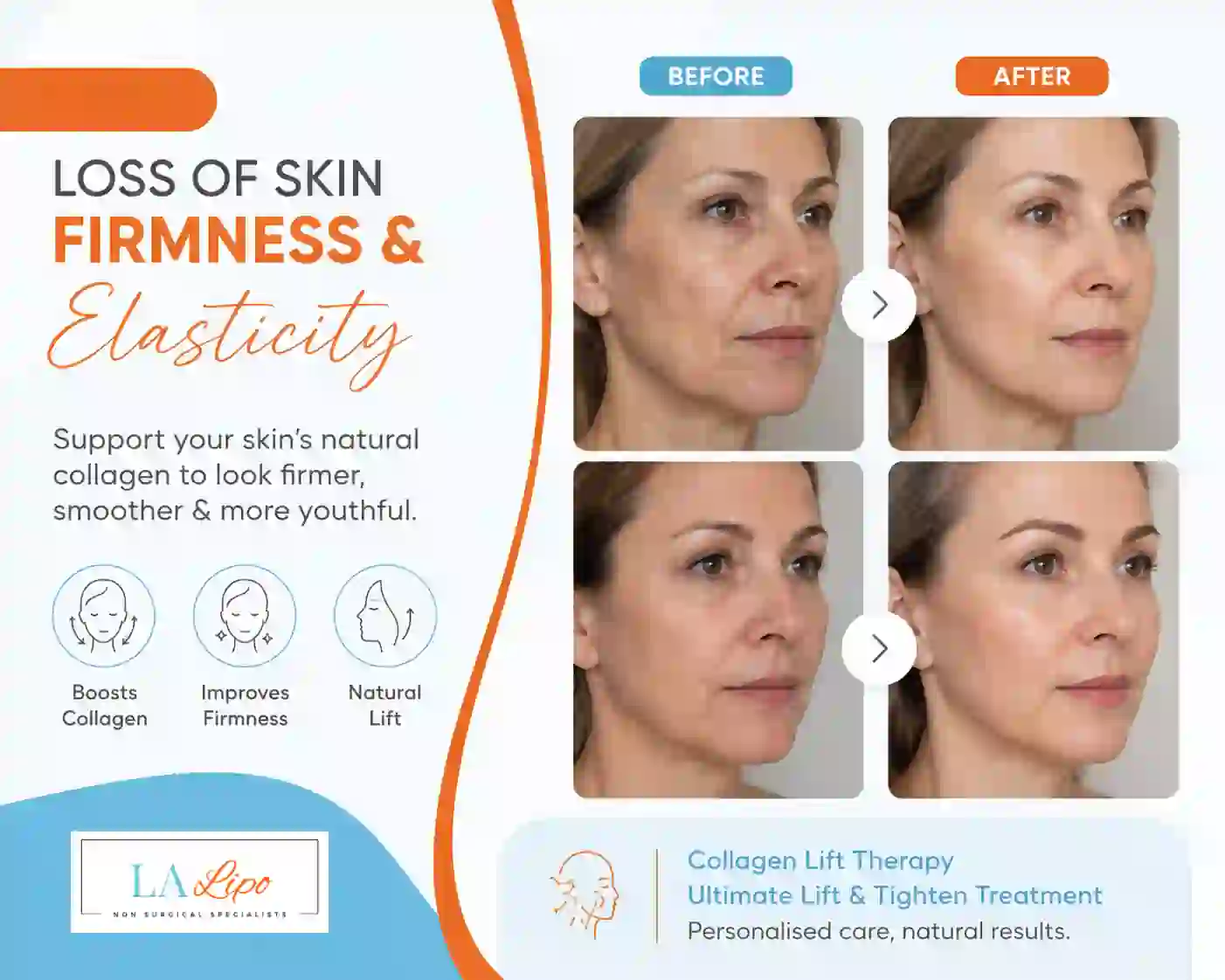 Sign #7: Loss of Skin Firmness and Elasticity Wanstead