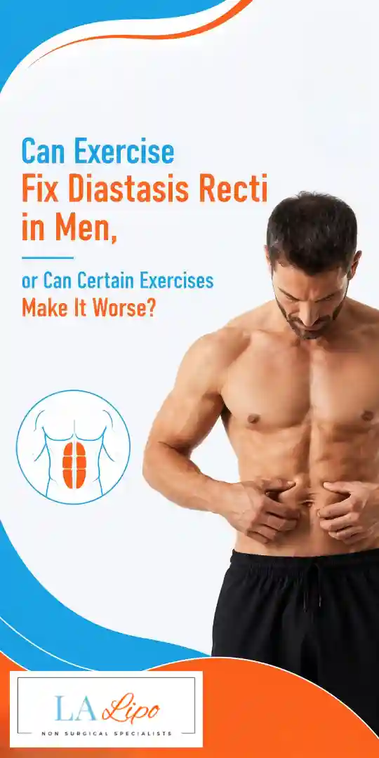 Can Exercise Fix Diastasis Recti in Men, or Can Certain Exercises Make It Worse Wanstead?