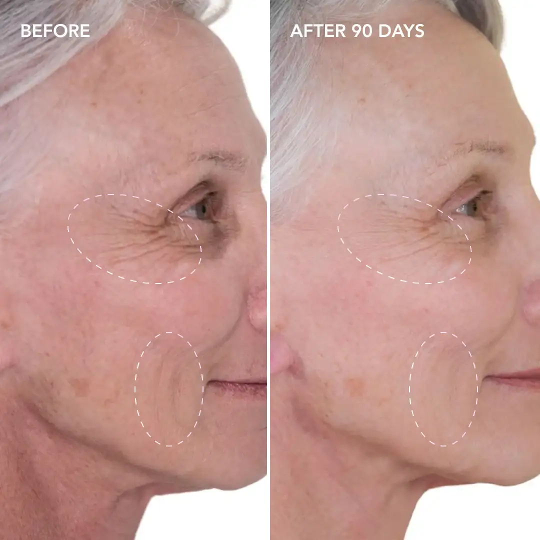 When will you see results Wanstead